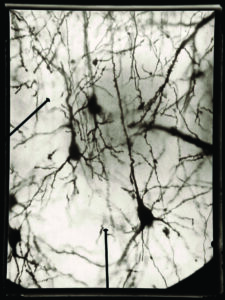 Microfotografía científica de las células piramidales con tinción de Golgi por Ramón y Cajal. 