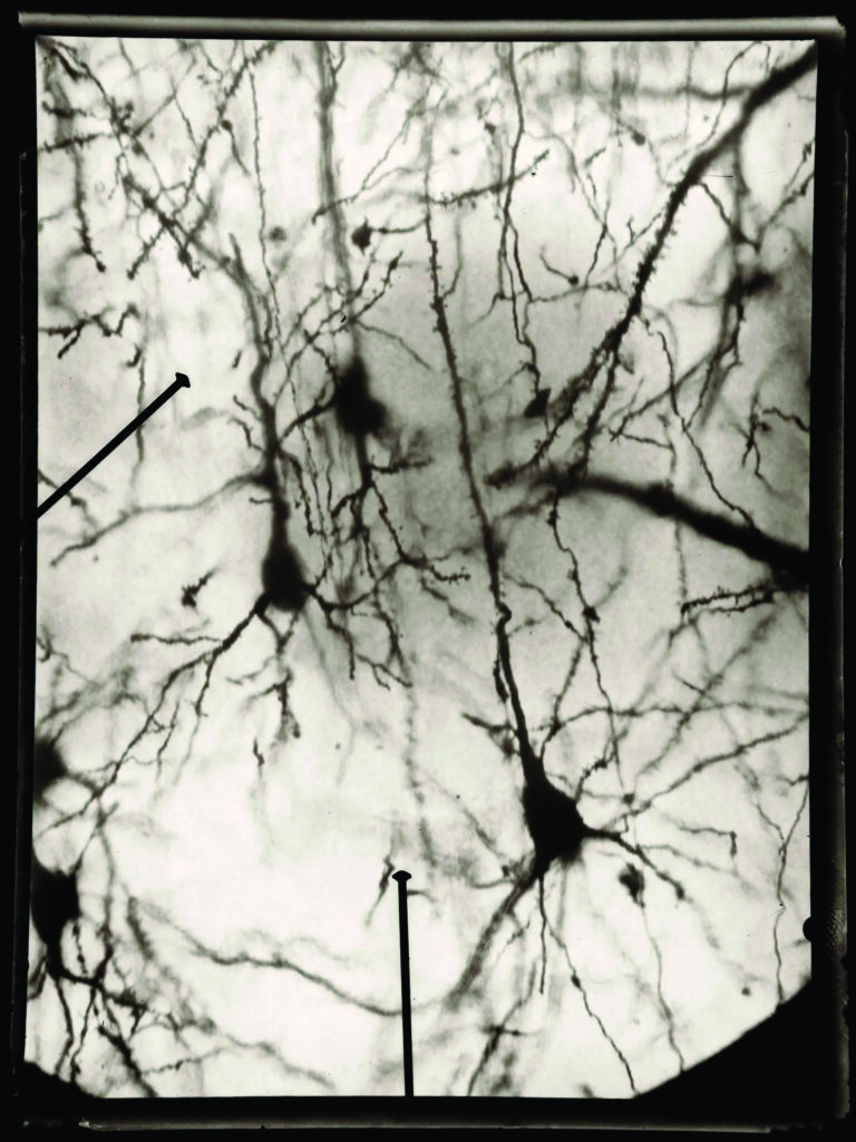 Microfotografía científica de las células piramidales con tinción de Golgi por Ramón y Cajal.